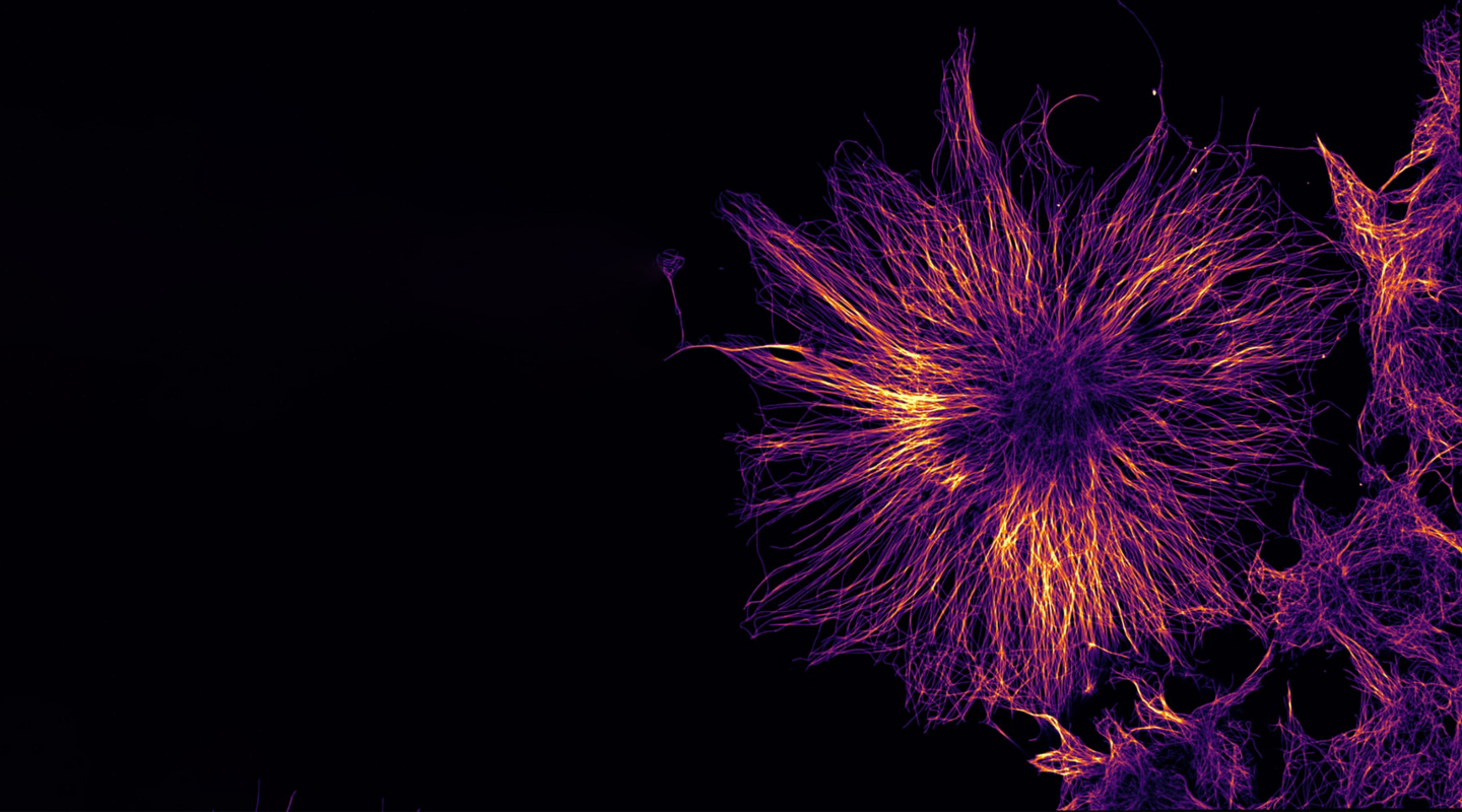 FISBA READYBeam Laseroptics Laser Module Headerimage Tubulin Filaments in a COS 2 cel