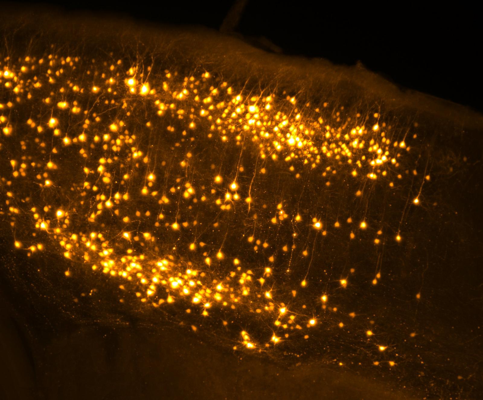 Nahaufnahme von fluoreszierenden Maushirnzellen